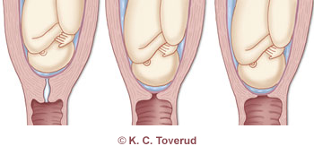 latensfasen av f&oslash;dsel